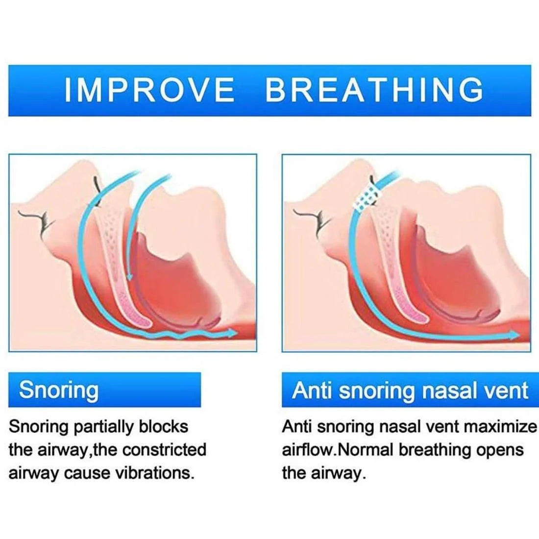 6Pcs Large anti Snoring Dilators, Snore Stopper Device Nose Vents Nasal Dilator Breathing Sleeping Relief